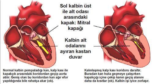 Yeşil sahada trajedi