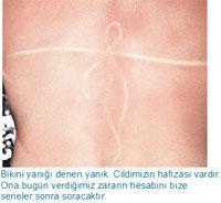 DAHA ÇOK GÜNEŞ DAHA AZ KANSER