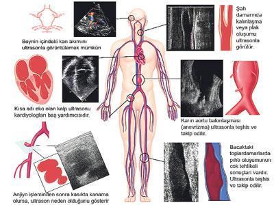 Kalbi görmenin yolu: Ultrason