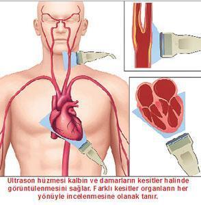 Kalbi görmenin yolu: Ultrason