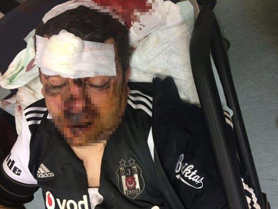 Otobüsten düşen Beşiktaş taraftarı hayati tehlikeyi atlattı