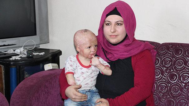 2 yaşındaki Ahmetin yaşaması 170 bin liranın bulunmasına bağlı