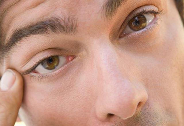 Sağ ve sol göz seğirmesinin nedenleri - Göz seyirmesi neden olur, gözler neden seğirir