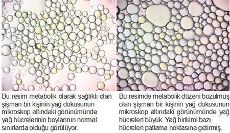 ‘Sağlıklı Şişman’da kilolar dert değil