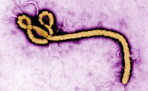 Ebola Virüsü nedir