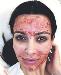 KIM KARDASHIAN  NASIL GÜZELLEŞTi