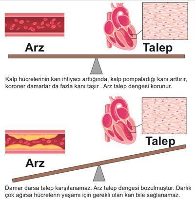 3 aşamada kalp krizi tedavisi