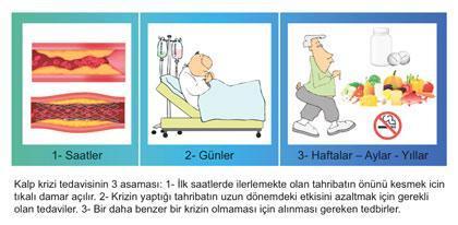 3 aşamada kalp krizi tedavisi