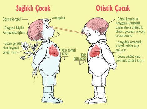 “ÇOCUĞUM  NEDEN OTİSTİK”