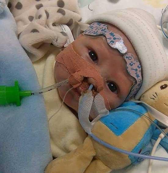 İngilterede 8 haftalık bebeğe kalp nakli yapıldı