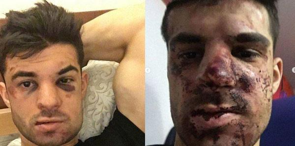 Zenitli futbolcu Denis Terentievi fena dövdüler
