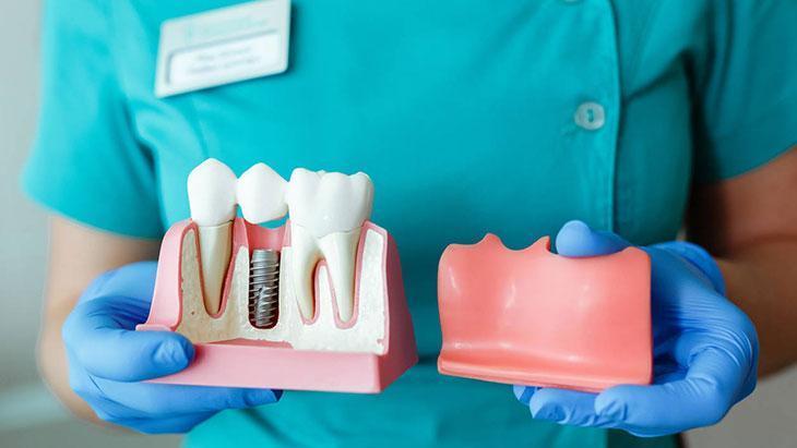 İmplant herkese uygulanır mı