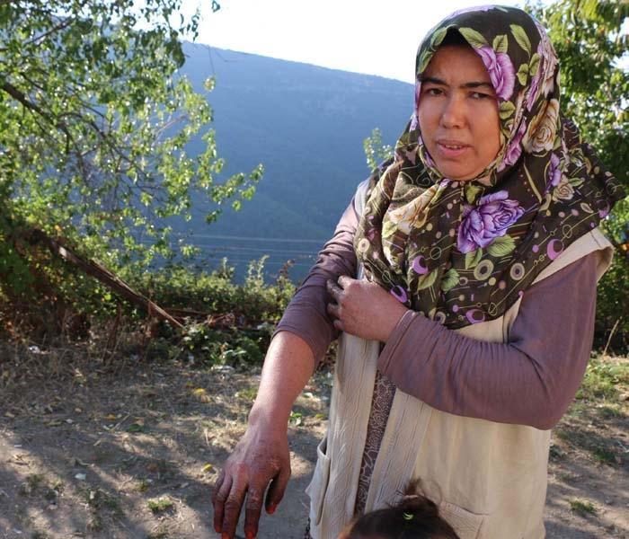 Turgutlunun 7 mahallesi balık pulu hastalığıyla boğuşuyor
