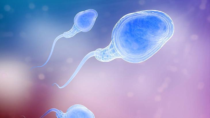 5-Testosteron artışı ile sperm üretimi sağlanabilir