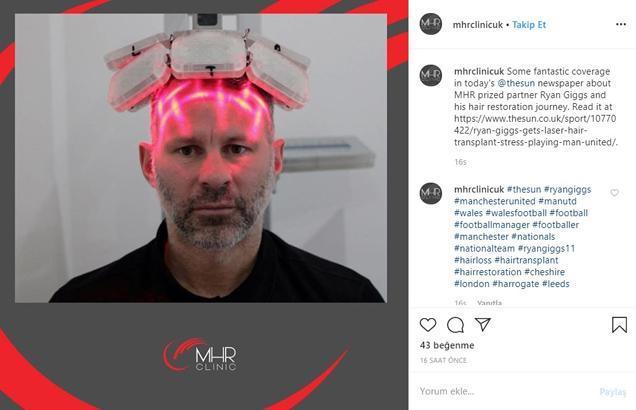 Efsane isim saç ektirmeye karar verdi Saklanıyordum...