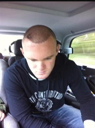 Efsane isim saç ektirmeye karar verdi Saklanıyordum...