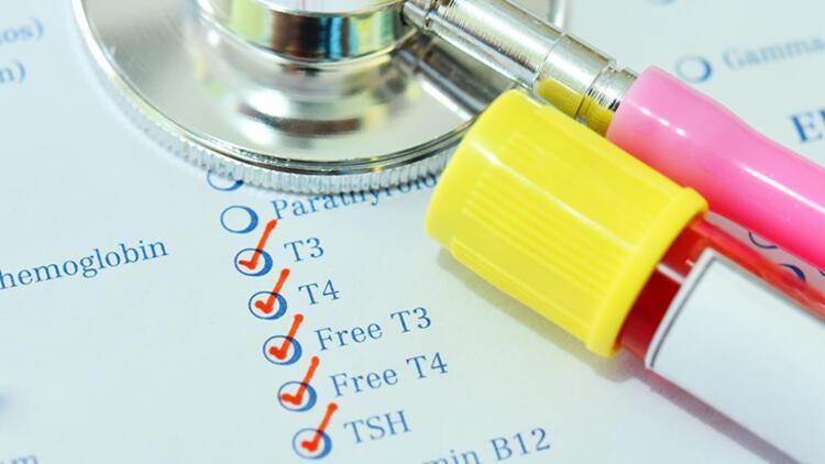 Zehirli guatr olup olmadığı nasıl anlaşılır Zehirli guatr olup olmadığı nasıl anlaşılır