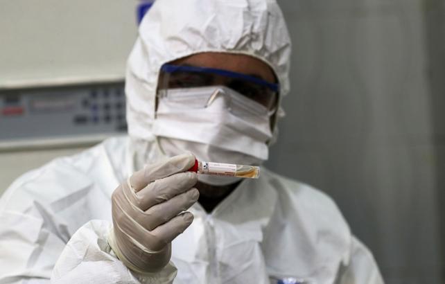 Son dakika haber..Beklenen oldu Dünyayı sarsan corona virüs raporu açıklandı Son dakika haber..Beklenen oldu Dünyayı sarsan corona virüs raporu açıklandı