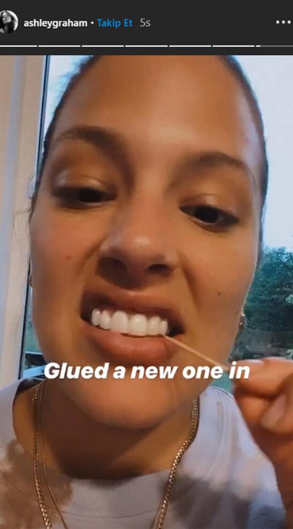 Ashley Grahamin kurabiye yerken dişi kırıldı