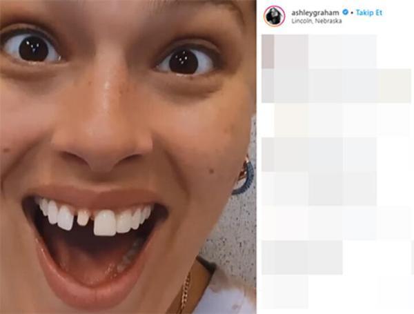 Ashley Grahamin kurabiye yerken dişi kırıldı