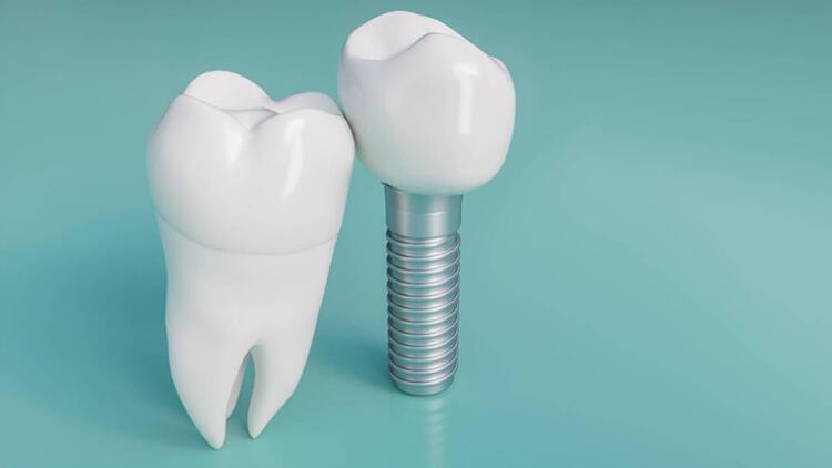 İmplant sonrası bunları yemeyin