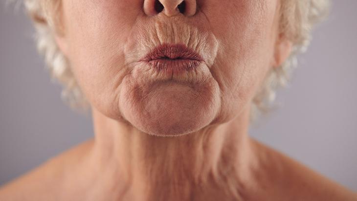 Dudak üstü sigara çizgilerini geçirmenin yolu - Yüzdeki barkod çizgileri nasıl tedavi edilir Dudak üstü sigara çizgilerini geçirmenin yolu - Yüzdeki barkod çizgileri nasıl tedavi edilir