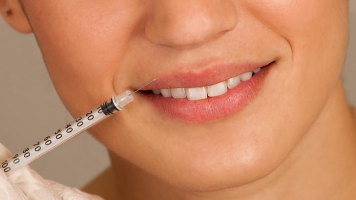 Dudak üstü sigara çizgilerini geçirmenin yolu - Yüzdeki barkod çizgileri nasıl tedavi edilir Dudak üstü sigara çizgilerini geçirmenin yolu - Yüzdeki barkod çizgileri nasıl tedavi edilir