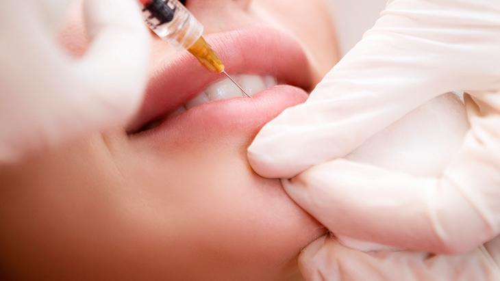 Dudak üstü sigara çizgilerini geçirmenin yolu - Yüzdeki barkod çizgileri nasıl tedavi edilir Dudak üstü sigara çizgilerini geçirmenin yolu - Yüzdeki barkod çizgileri nasıl tedavi edilir