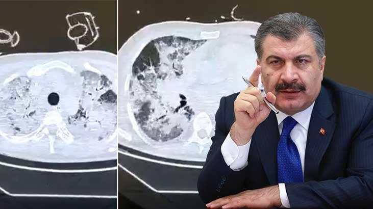 Sağlik bakani fahrettin koca'dan peş peşe paylaşimlar