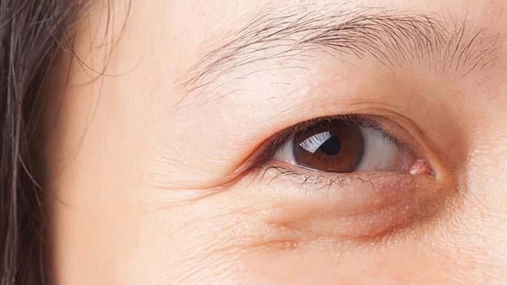 Tedavi sonrasında dikkat edilmesi gereken hususlar