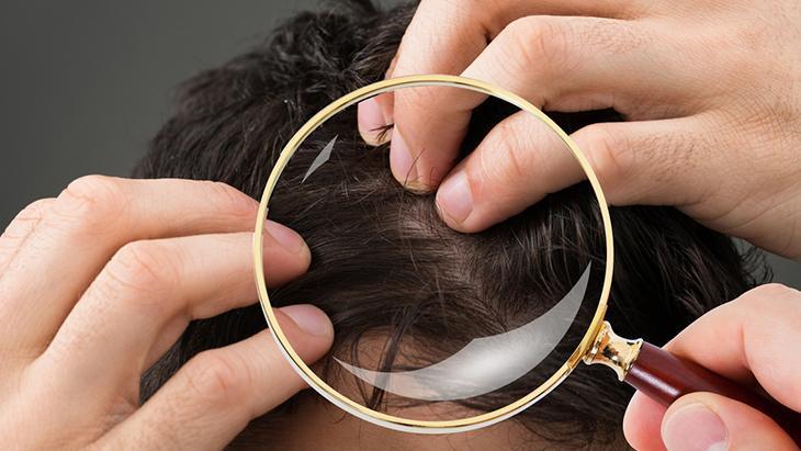 Koronavirüs sonrası saçların yenilenmesi için bunları tüketin Koronavirüs sonrası saçların yenilenmesi için bunları tüketin