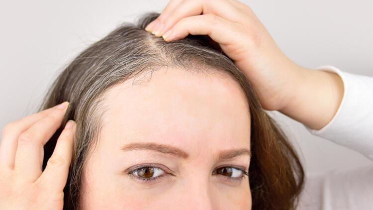 Stres, saçları erkenden beyazlatıyor