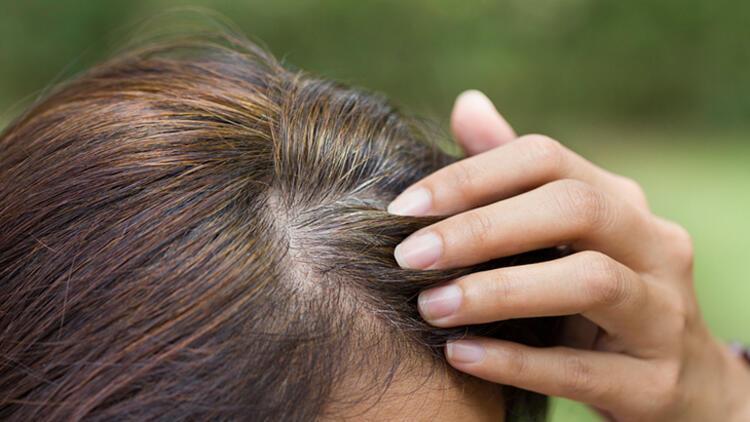 Genç yaşta saç beyazlamasını bu yöntem durdurabilir