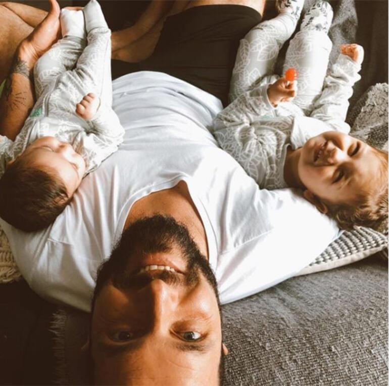 Berkay saç ektirdi: Nasıl olmuş