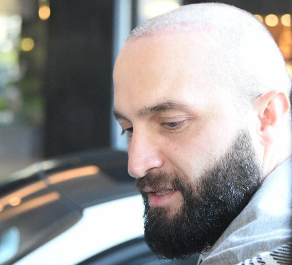 Berkay saç ektirdi: Nasıl olmuş