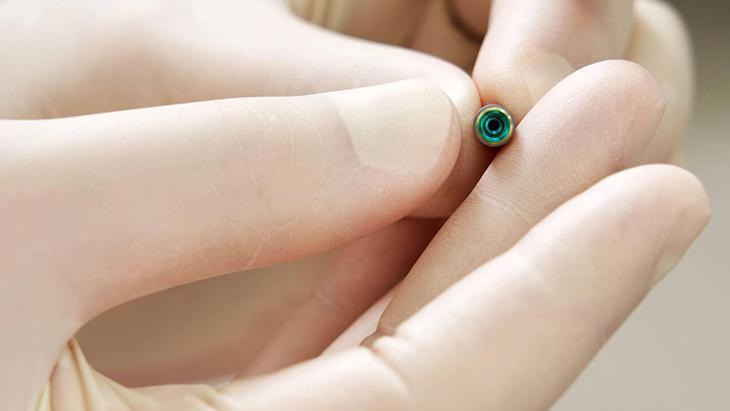 İmplant uygulaması ile dişlerin tedavi edilmesi neden önemli İmplant uygulaması ile dişlerin tedavi edilmesi neden önemli