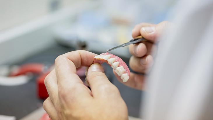 Diş implantları ile gerçek diş arasında bir fark var mı