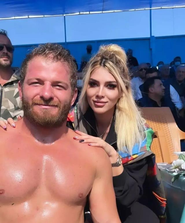 Survivor İlayda Şekerin kardeşinden estetik yorumu