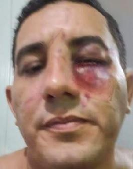 Politikacılar dövüştü, biletler 100 dolara satıldı
