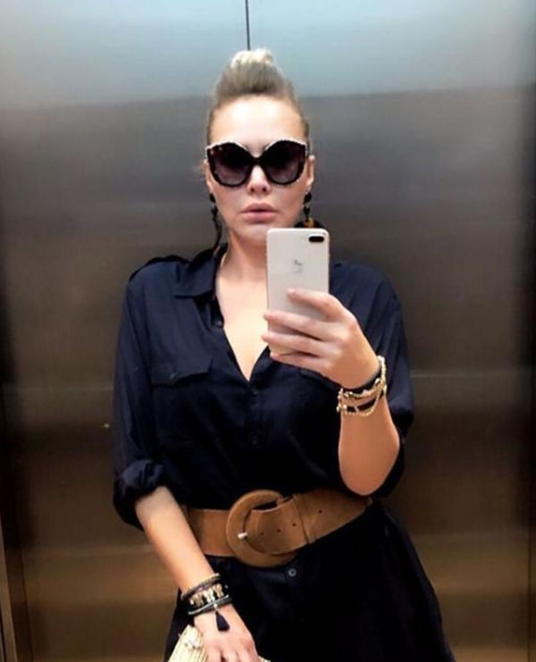 Volkan Aslandan eşi Aylin Coşkuna büyük jest Yüzünü koluna kazıttı