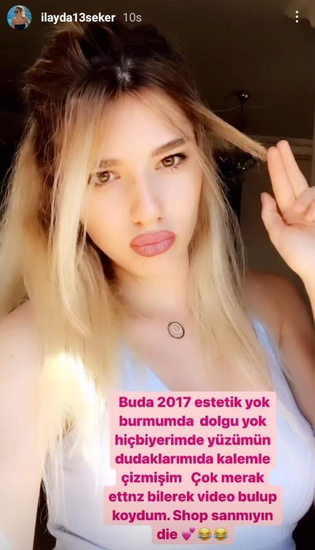 YÜZÜMÜN HİÇBİR YERİNDE DOLGU YOK