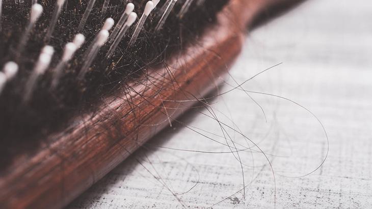 Tedavi saçkıranın çeşitlerine göre değişebiliyor