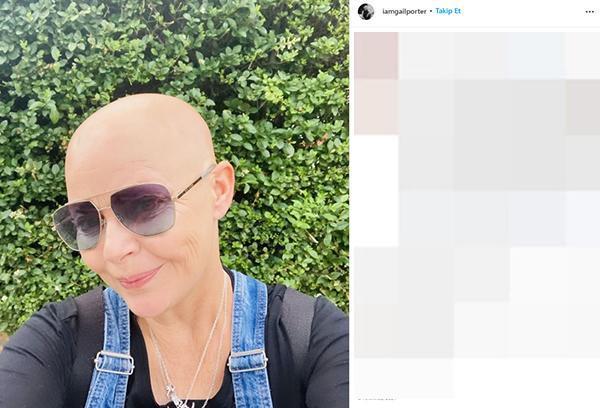 SEN SAÇLARINDAN VE KİRPİKLERİNDEN ÇOK DAHA FAZLASISIN