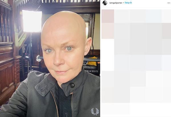 Gail Porter: Beni hiçbir şey yıkamaz