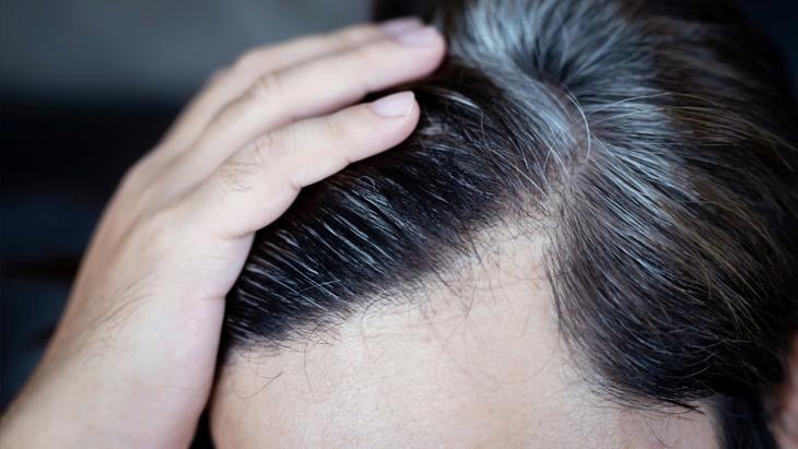 4- Demir depolarını doldurmak