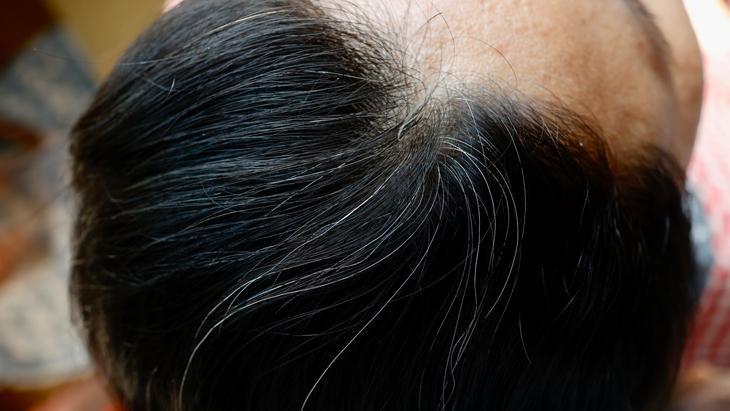 3- Kaliteli protein içeren besinler tüketmek