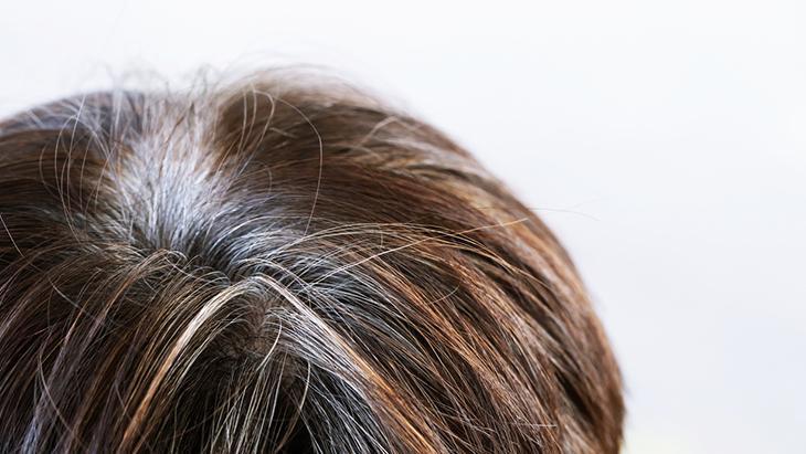 Genç yaşta saçları beyazlatan 6 neden Önlemek mümkünmüş, sırrı burada saklı