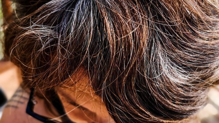 Genç yaşta saçları beyazlatan 6 neden Önlemek mümkünmüş, sırrı burada saklı