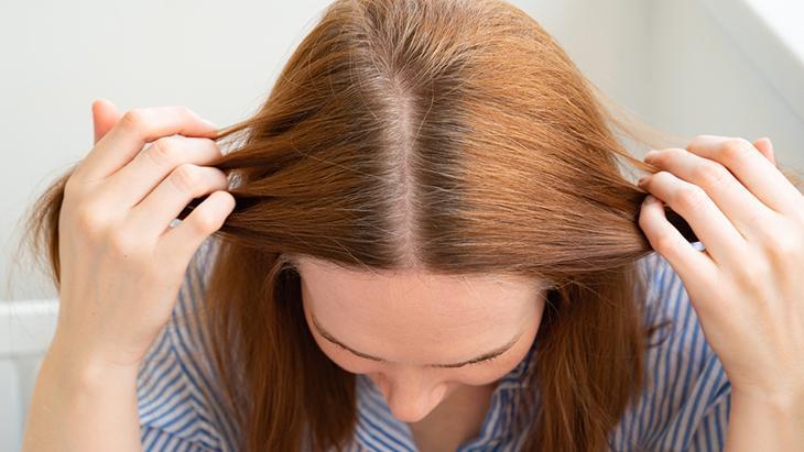 Genç yaşta saçları beyazlatan 6 neden Önlemek mümkünmüş, sırrı burada saklı