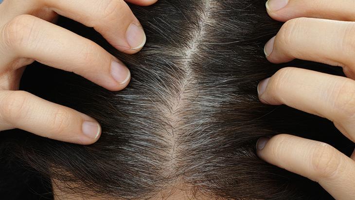 2-Tiroit fonksiyonlarında sorun olması